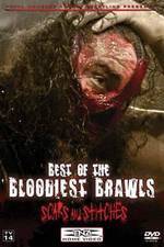 Watch TNA Wrestling: Best of the Bloodiest Brawls - Scars and Stitches Vumoo